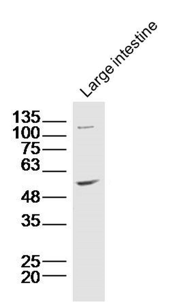 ZnT-1 Antibody in Western Blot (WB)