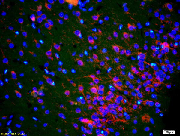 PEN2 Antibody in Immunohistochemistry (Paraffin) (IHC (P))