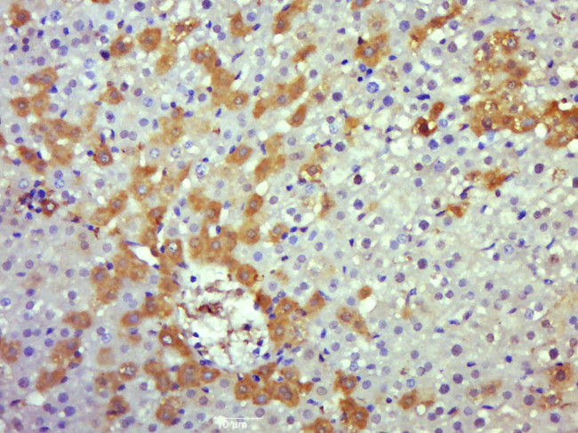 Caspase-8 subunit p18 Antibody in Immunohistochemistry (Paraffin) (IHC (P))
