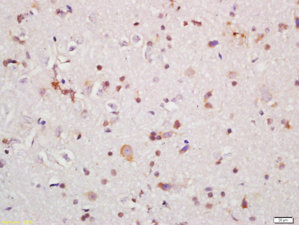 IRAK1 Antibody in Immunohistochemistry (Paraffin) (IHC (P))