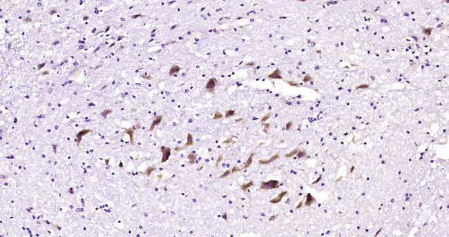 ITPR3 Antibody in Immunohistochemistry (Paraffin) (IHC (P))