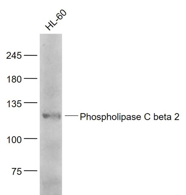 Phospholipase C beta 2 Antibody in Western Blot (WB)