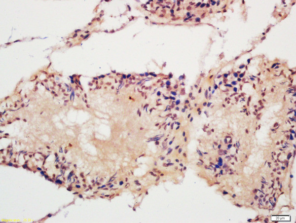 ACF1 Antibody in Immunohistochemistry (Paraffin) (IHC (P))