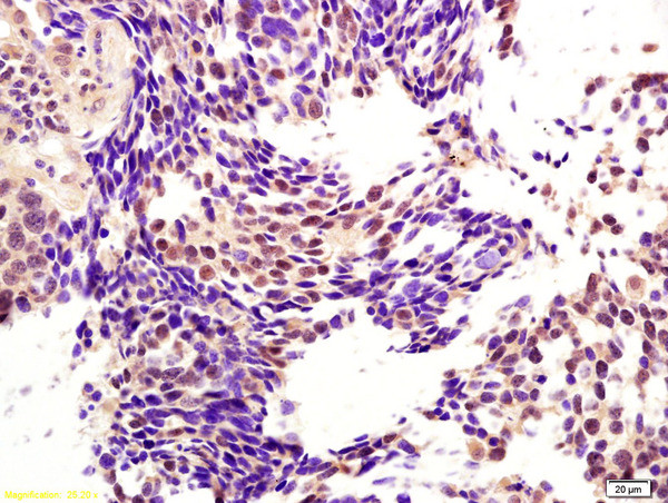 CENPH Antibody in Immunohistochemistry (Paraffin) (IHC (P))