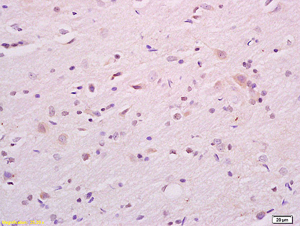CKAP4 Antibody in Immunohistochemistry (Paraffin) (IHC (P))