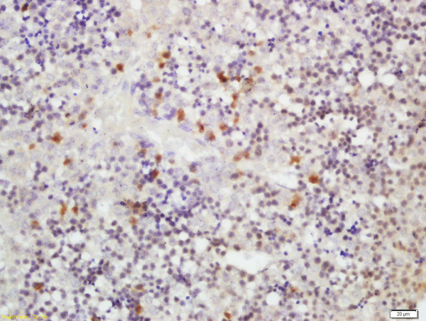 Clavesin Antibody in Immunohistochemistry (Paraffin) (IHC (P))