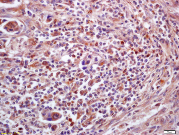 PPT1 Antibody in Immunohistochemistry (Paraffin) (IHC (P))