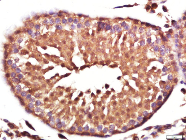 Vinculin Antibody in Immunohistochemistry (Paraffin) (IHC (P))