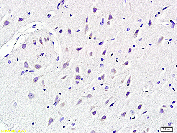KCNN4 Antibody in Immunohistochemistry (Paraffin) (IHC (P))