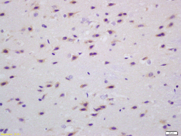 Transglutaminase Antibody in Immunohistochemistry (Paraffin) (IHC (P))