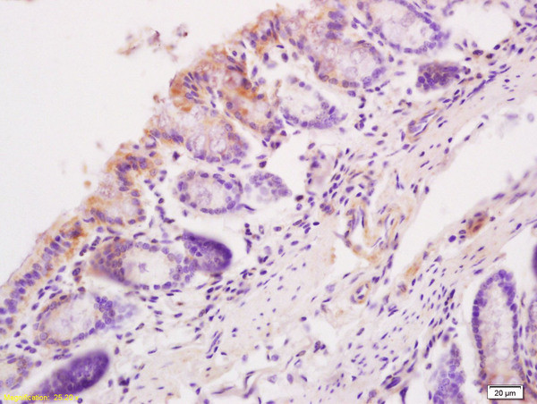 Sema3C Antibody in Immunohistochemistry (Paraffin) (IHC (P))