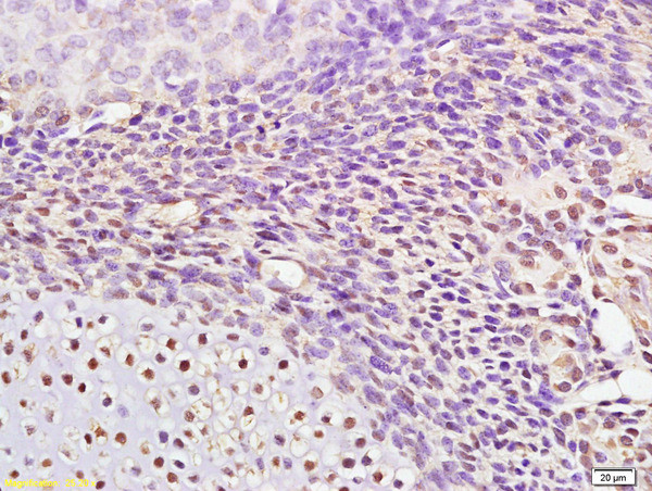 AP2 gamma Antibody in Immunohistochemistry (Paraffin) (IHC (P))