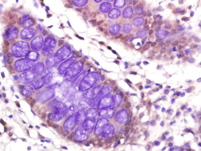 PP2A beta Antibody in Immunohistochemistry (Paraffin) (IHC (P))