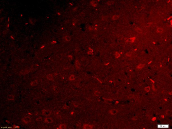 Netrin G1 ligand Antibody in Immunohistochemistry (Paraffin) (IHC (P))