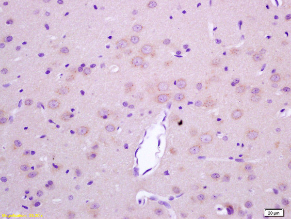 LGI1 Antibody in Immunohistochemistry (Paraffin) (IHC (P))