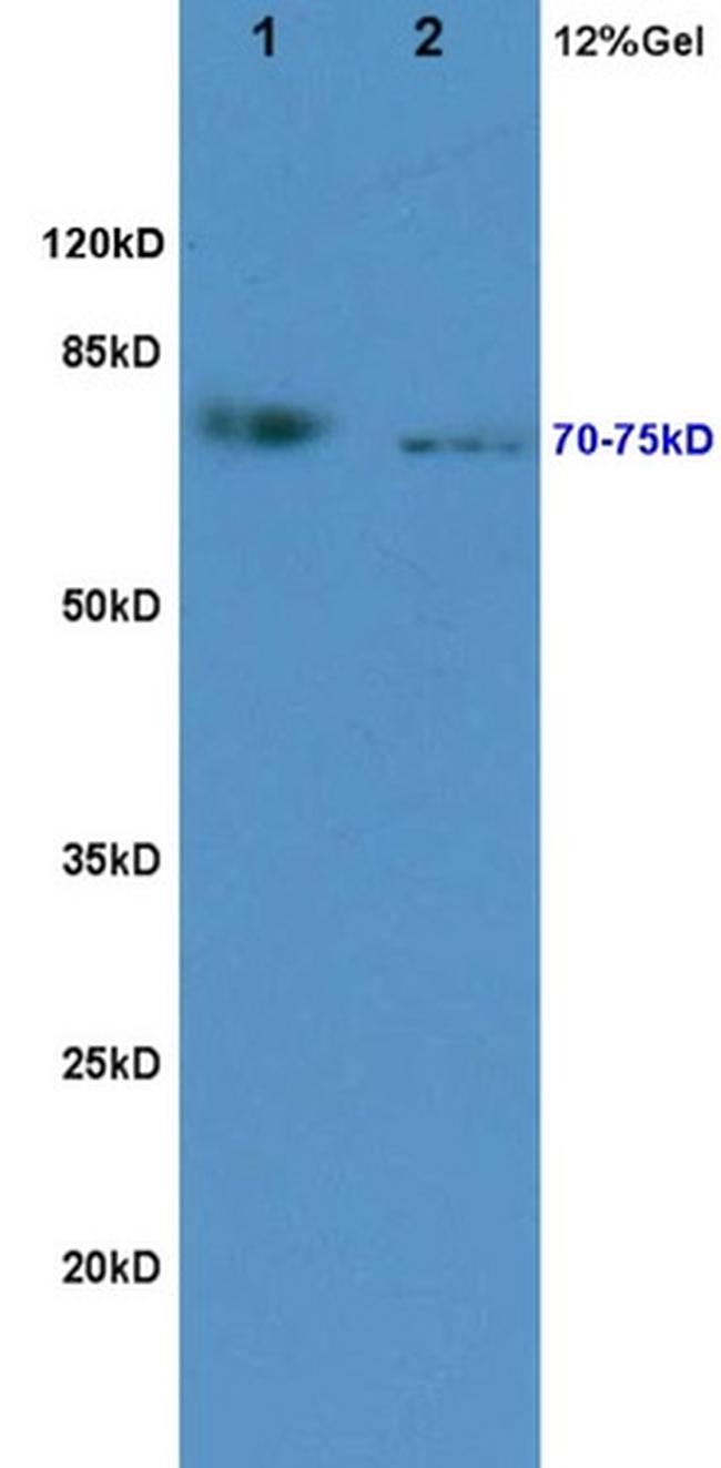 KIRREL2 Antibody in Western Blot (WB)