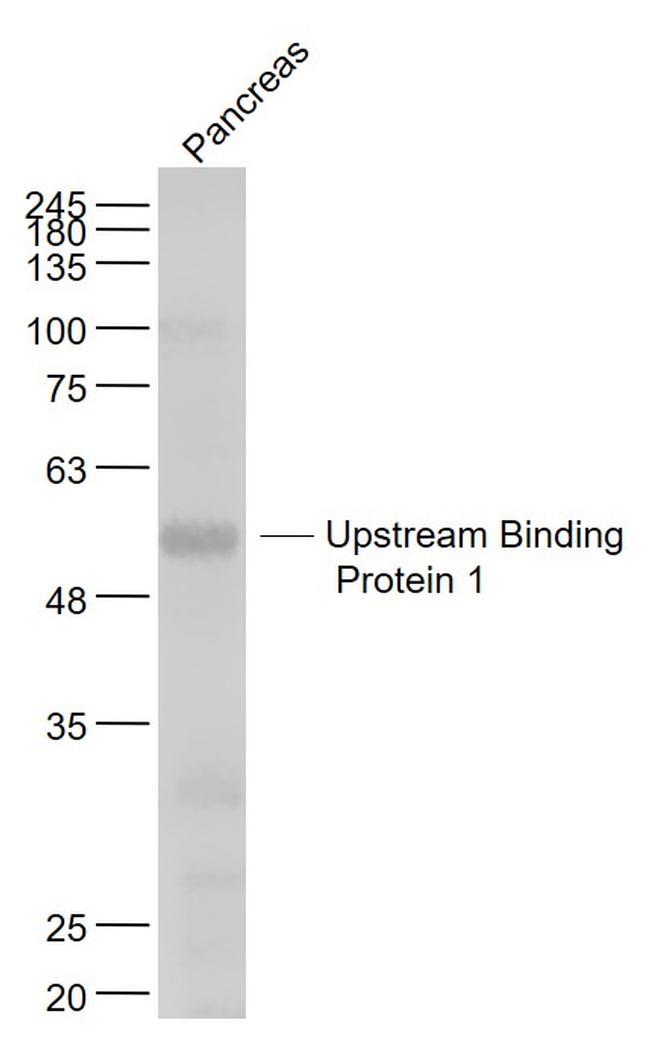 Upstream Binding Protein 1 Antibody in Western Blot (WB)