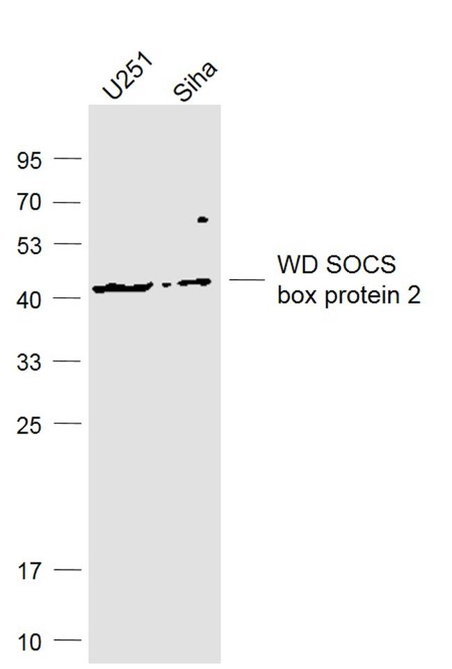 WD SOCS box protein 2 Antibody in Western Blot (WB)