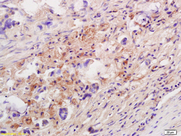 IL-10 Antibody in Immunohistochemistry (Paraffin) (IHC (P))