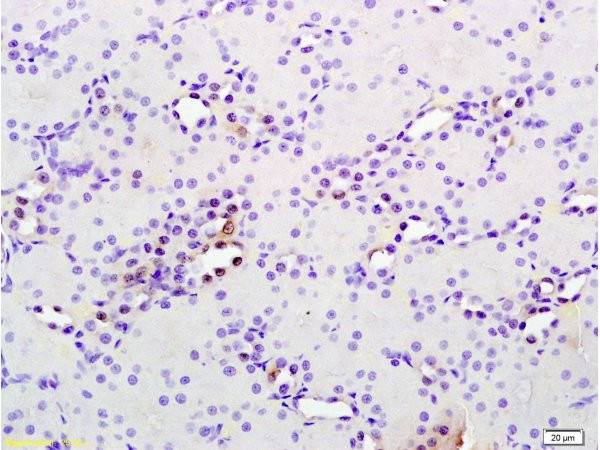 Phospho-MAP3K9 (Thr312) Antibody in Immunohistochemistry (Paraffin) (IHC (P))