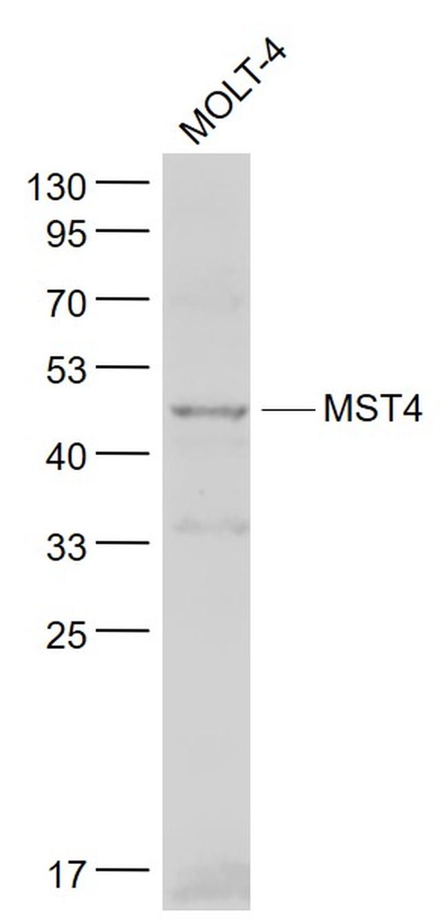 STK26 Antibody in Western Blot (WB)