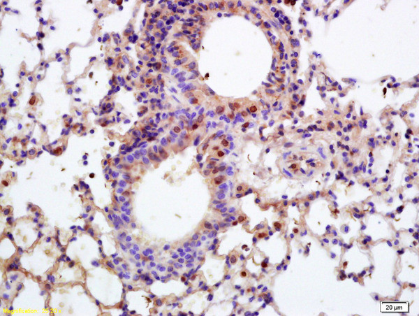 APPD Antibody in Immunohistochemistry (Paraffin) (IHC (P))