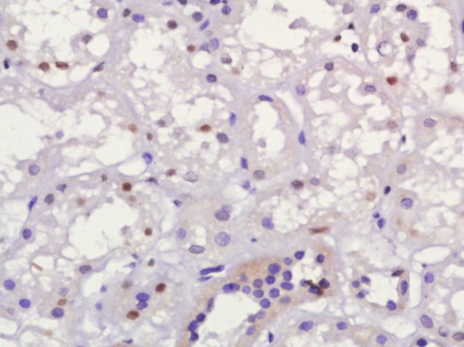 MUM1 Antibody in Immunohistochemistry (Paraffin) (IHC (P))