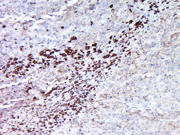 MAGEA5 Antibody in Immunohistochemistry (Paraffin) (IHC (P))