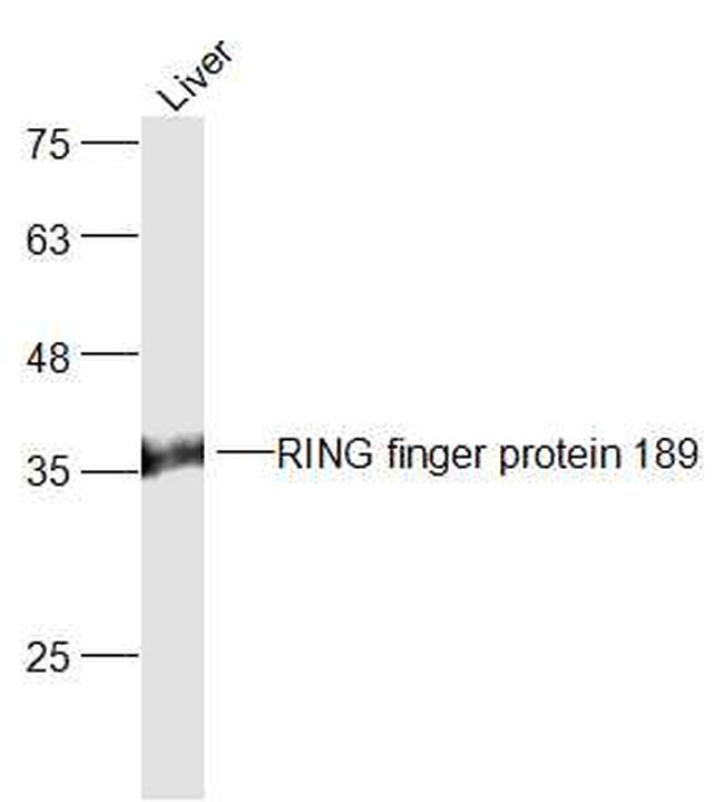 RING finger protein 189 Antibody in Western Blot (WB)