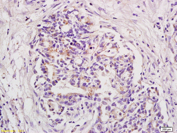 BOD1 Antibody in Immunohistochemistry (Paraffin) (IHC (P))