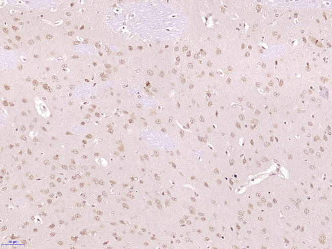 FRS2 Antibody in Immunohistochemistry (Paraffin) (IHC (P))