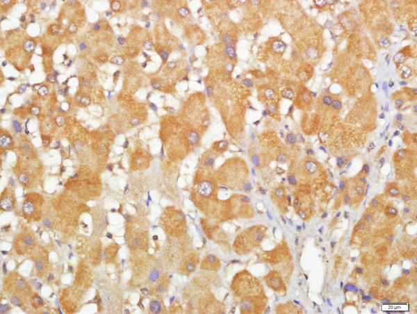 CCDC69 Antibody in Immunohistochemistry (Paraffin) (IHC (P))