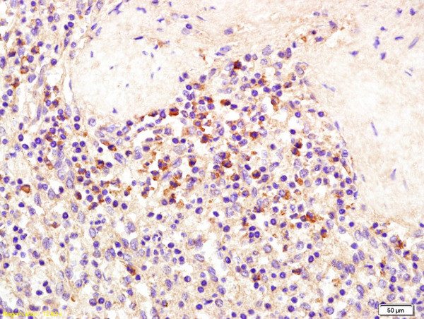 SEMA4D Antibody in Immunohistochemistry (Paraffin) (IHC (P))