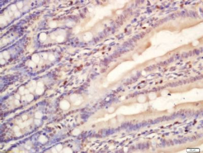 RNA polymerase 2 Antibody in Immunohistochemistry (Paraffin) (IHC (P))