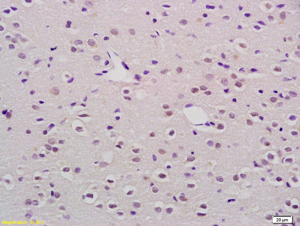 Mkl1 Antibody in Immunohistochemistry (Paraffin) (IHC (P))