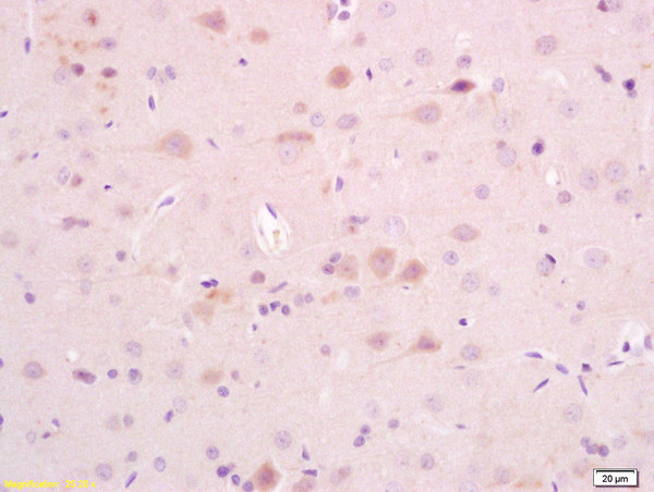 AKAP5 Antibody in Immunohistochemistry (Paraffin) (IHC (P))