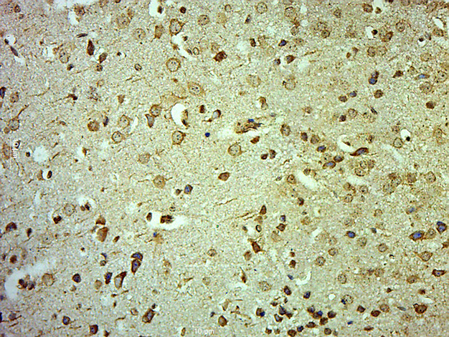 CLCN3 Antibody in Immunohistochemistry (Paraffin) (IHC (P))