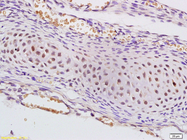 SAP62 Antibody in Immunohistochemistry (Paraffin) (IHC (P))