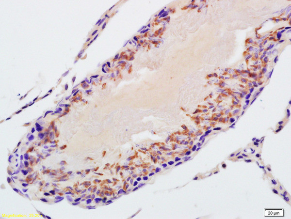 STK31 Antibody in Immunohistochemistry (Paraffin) (IHC (P))