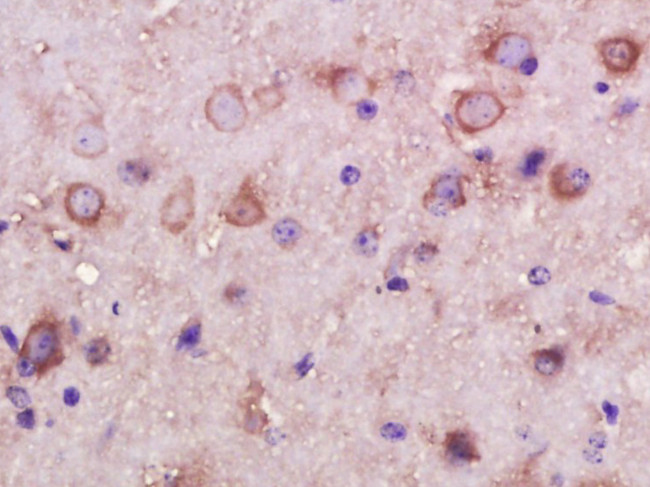 INPPL1 Antibody in Immunohistochemistry (Paraffin) (IHC (P))