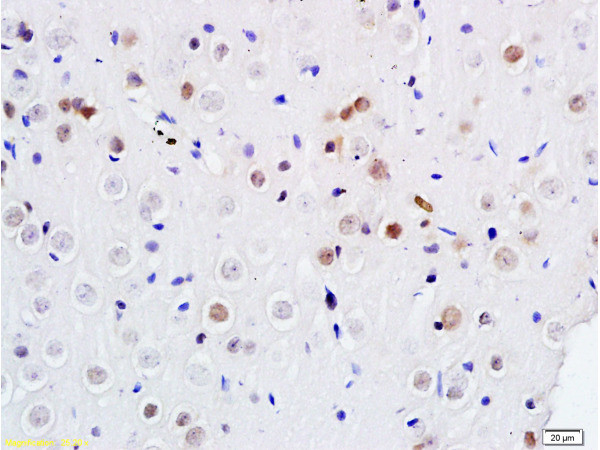 DENTT Antibody in Immunohistochemistry (Paraffin) (IHC (P))