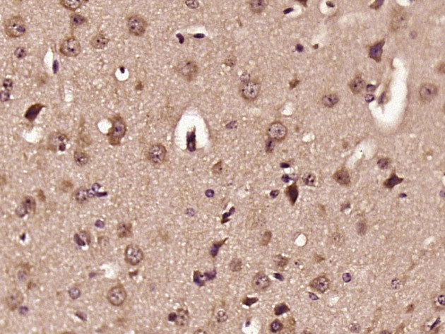 ELOVL2 Antibody in Immunohistochemistry (Paraffin) (IHC (P))
