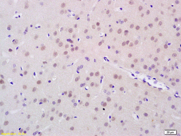 FTO Antibody in Immunohistochemistry (Paraffin) (IHC (P))