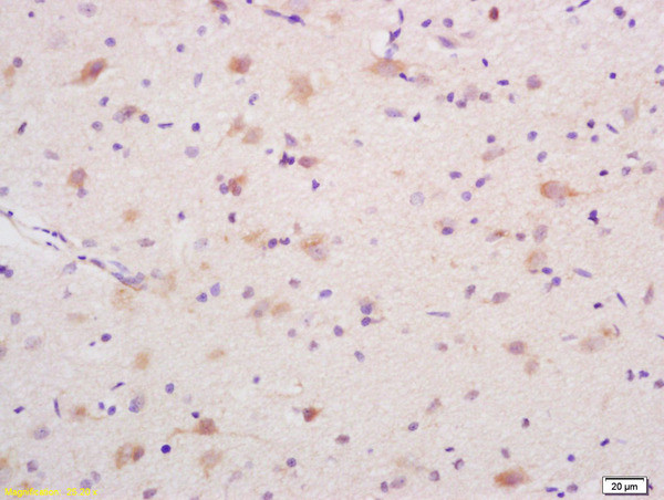 DEDD1 Antibody in Immunohistochemistry (Paraffin) (IHC (P))