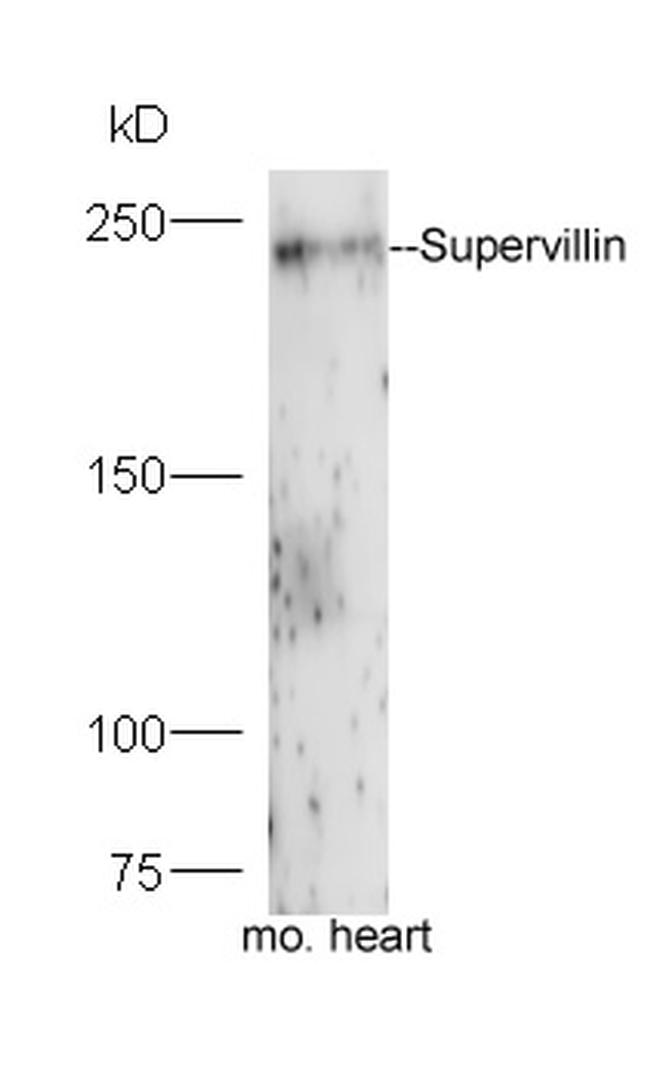 Supervillin Antibody in Western Blot (WB)