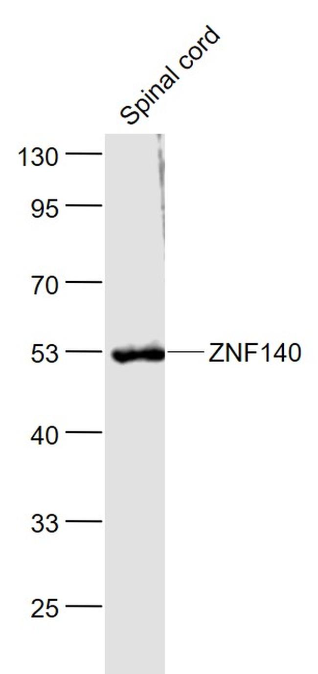 ZNF140 Antibody in Western Blot (WB)