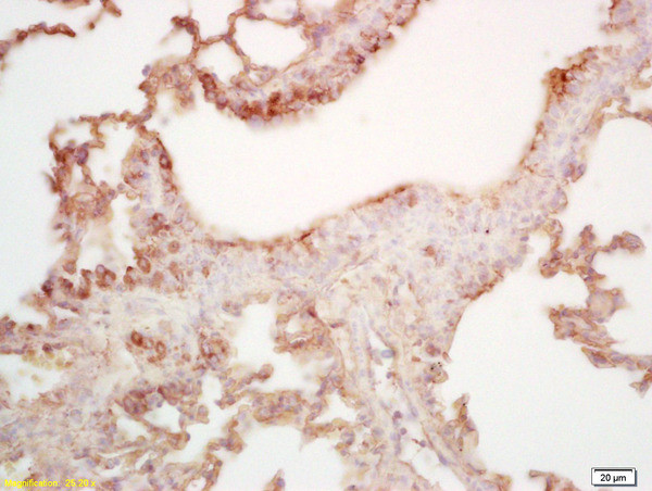 MAL2 Antibody in Immunohistochemistry (Paraffin) (IHC (P))