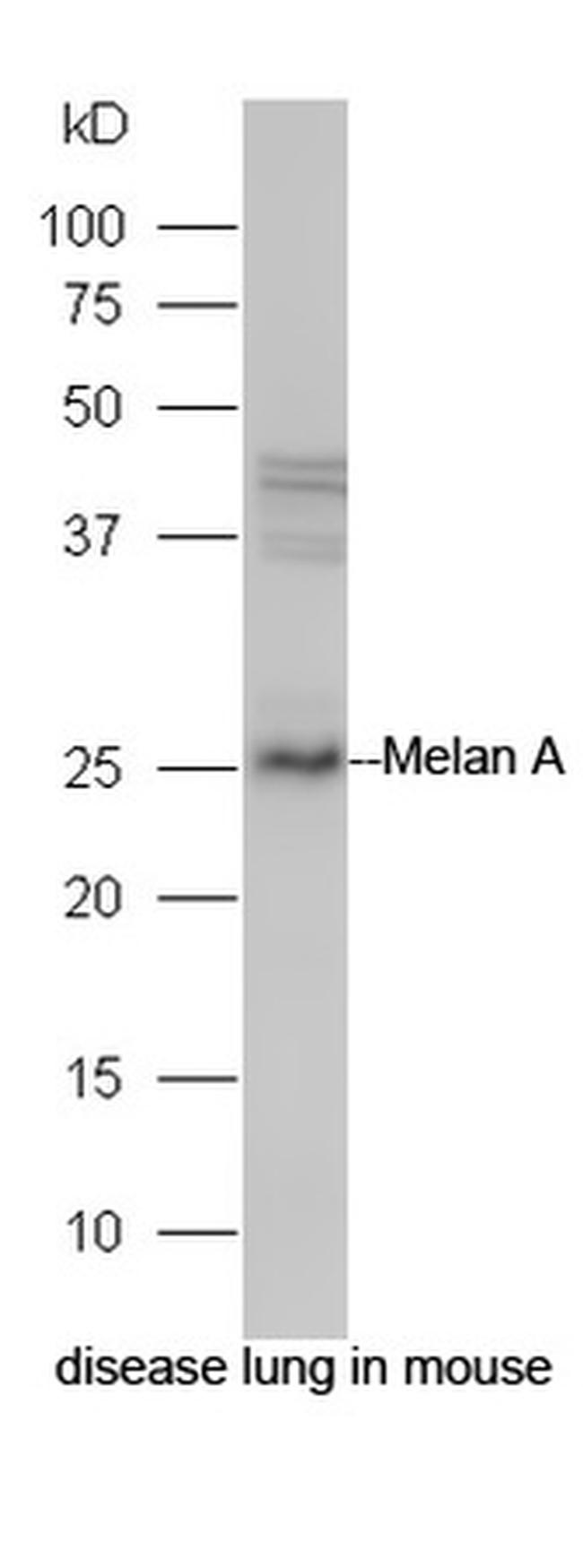 Melan A Antibody in Western Blot (WB)