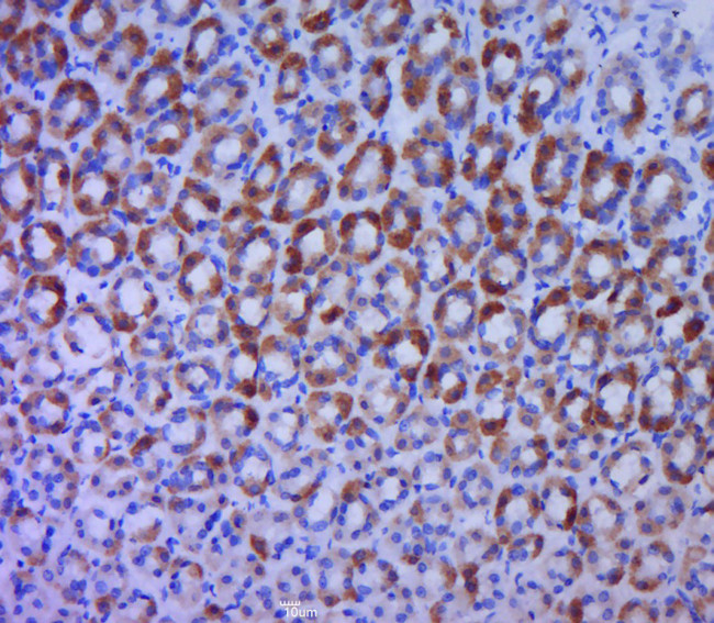 BTG1/BTG2 Antibody in Immunohistochemistry (Paraffin) (IHC (P))