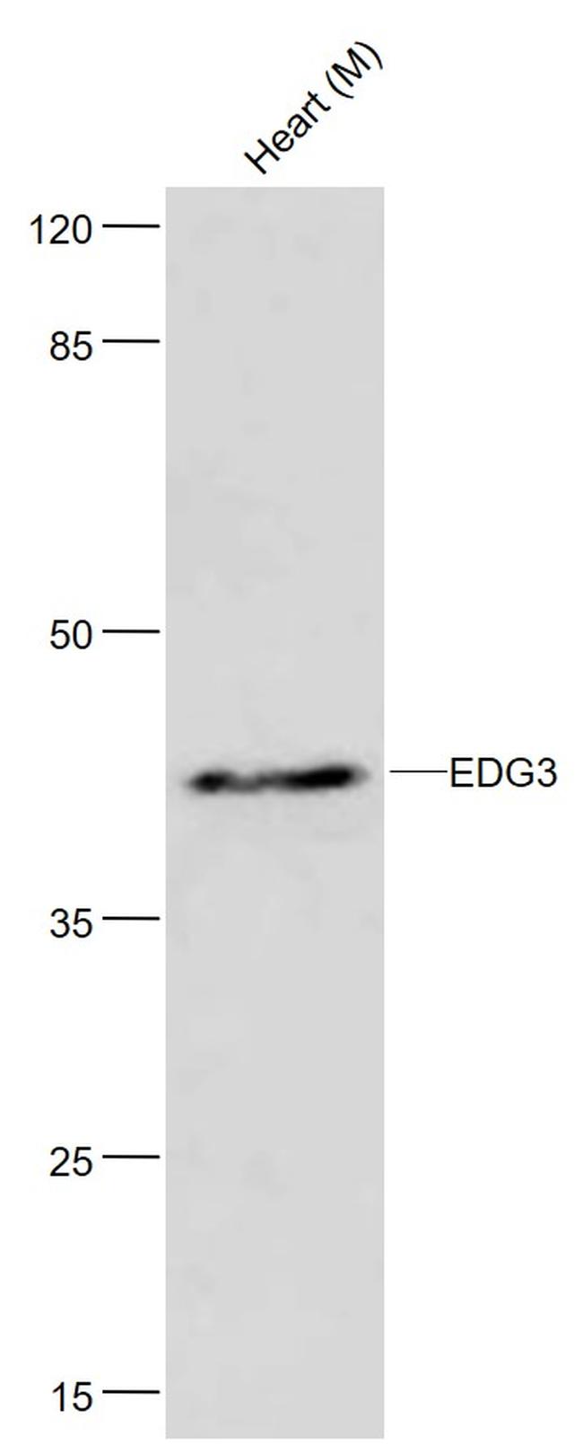 EDG3 Antibody in Western Blot (WB)